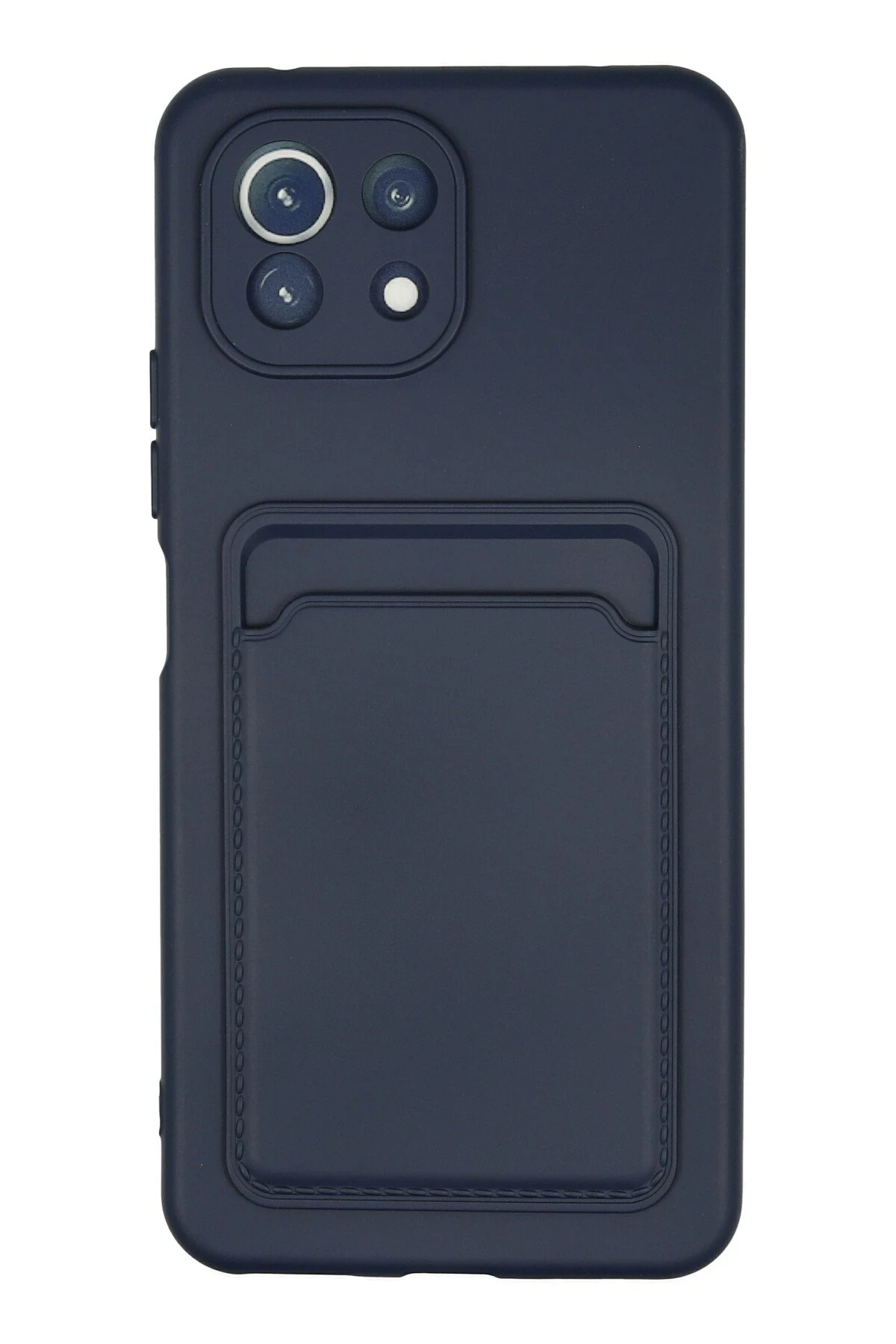 Newface Xiaomi Mİ 11 Lite Kılıf Kelvin Kartvizitli Silikon - Lacivert