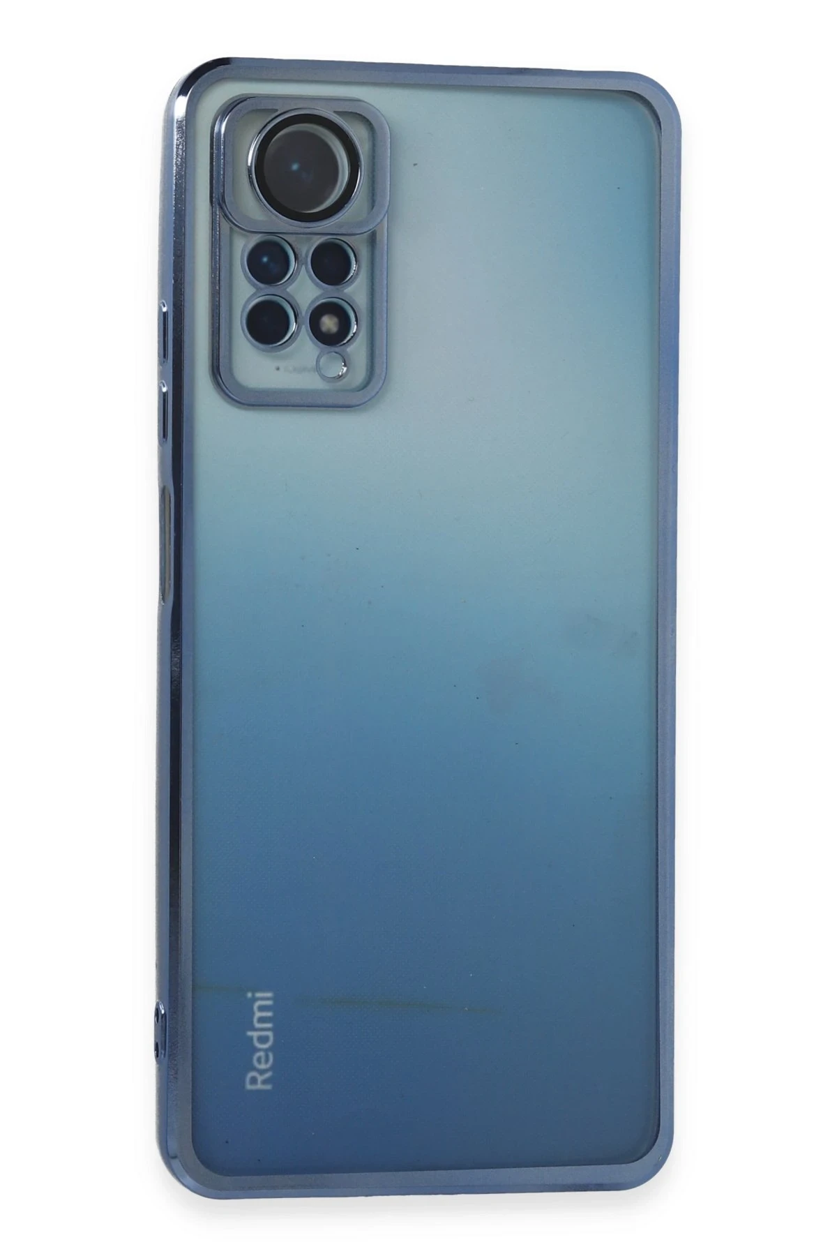 Newface Xiaomi Redmi Note 11 Pro Kılıf Razer Lensli Silikon - Açık Mavi