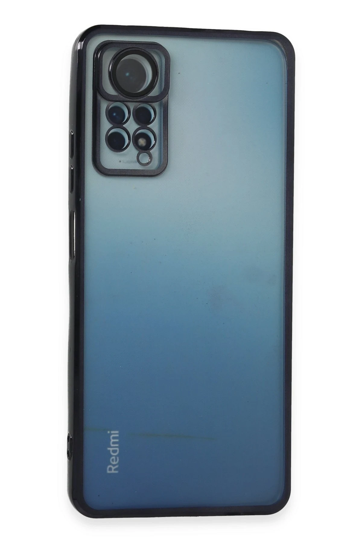 Newface Xiaomi Redmi Note 11 Pro Kılıf Razer Lensli Silikon - Siyah