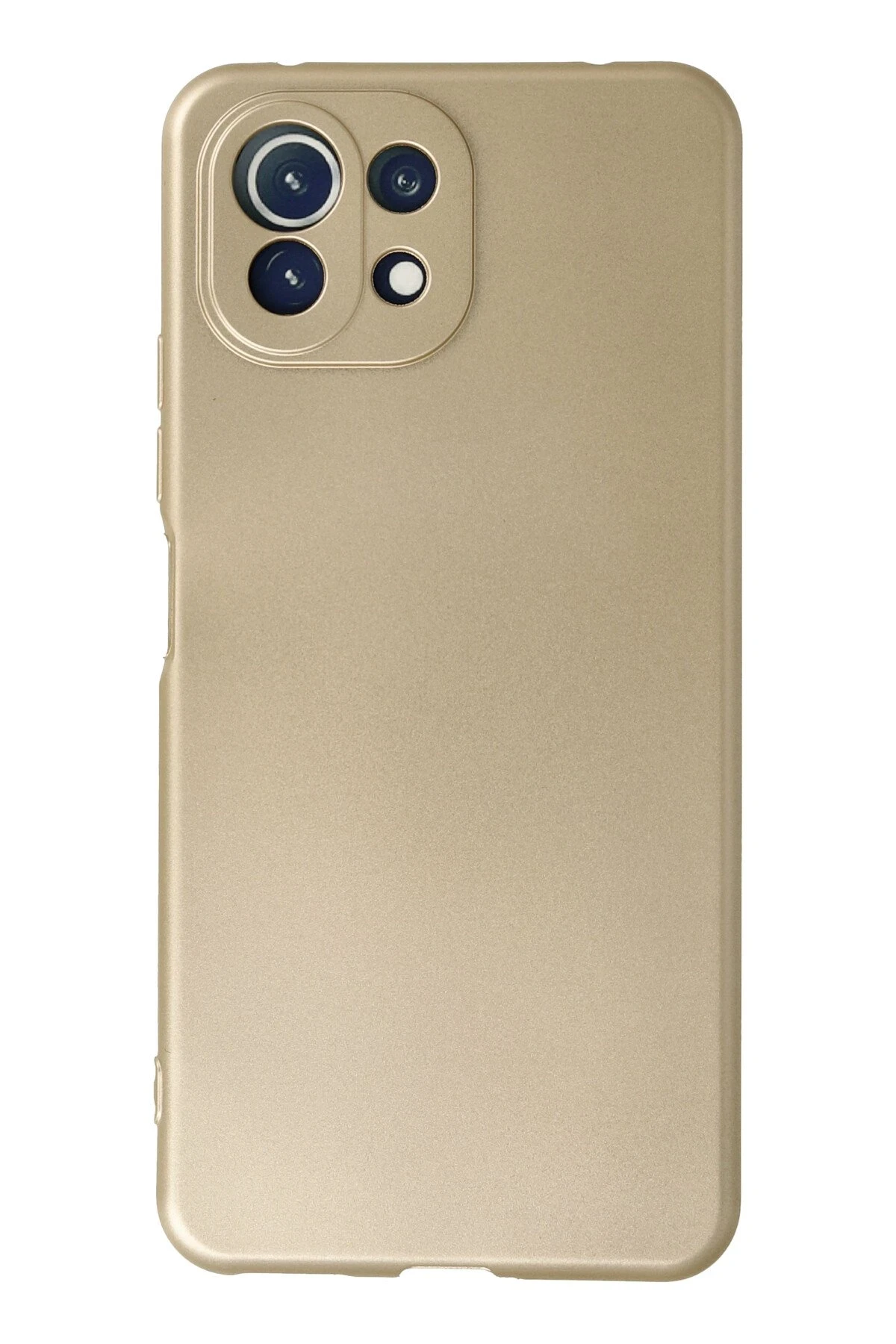 Newface Xiaomi Mİ 11 Lite Kılıf First Silikon - Gold