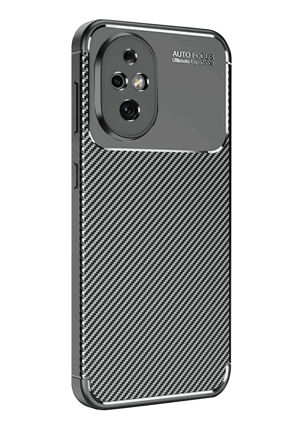 Newface Honor 200 Kılıf Auto Focus Karbon Kapak - Siyah